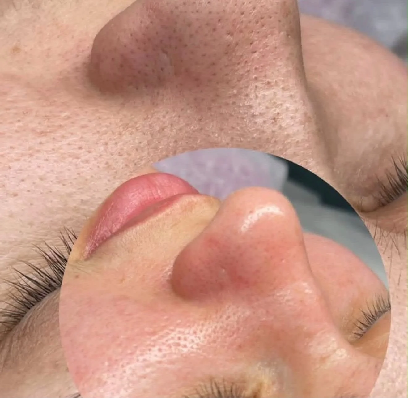 Limpieza facial